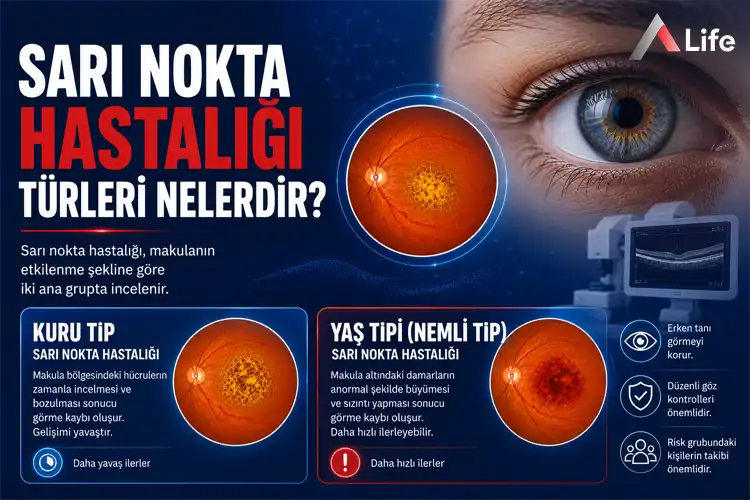 sari-nokta-hastaligi-turleri-nelerdir_3a15e16a.webp