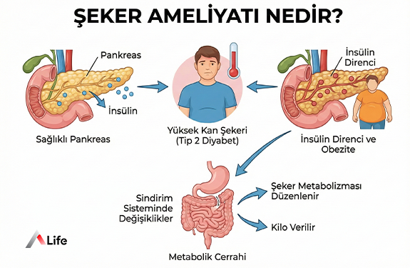 seker-ameliyati-nedir_591ed0f1.webp
