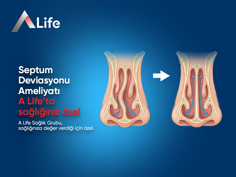 Septum Deviasyonu Ameliyatı
