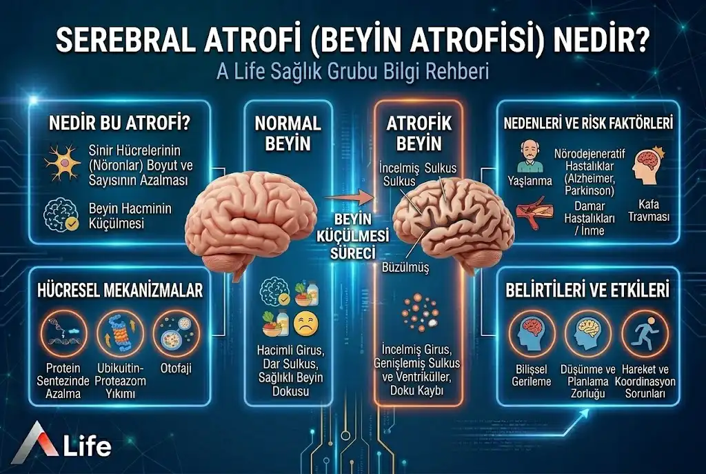 serebral-atrofi-beyin-atrofisi-nedir-a-life-ankara_3425629e.webp