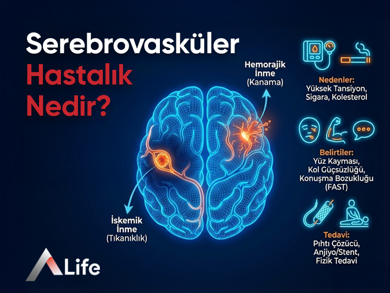Serebrovasküler Hastalık Nedir ?
