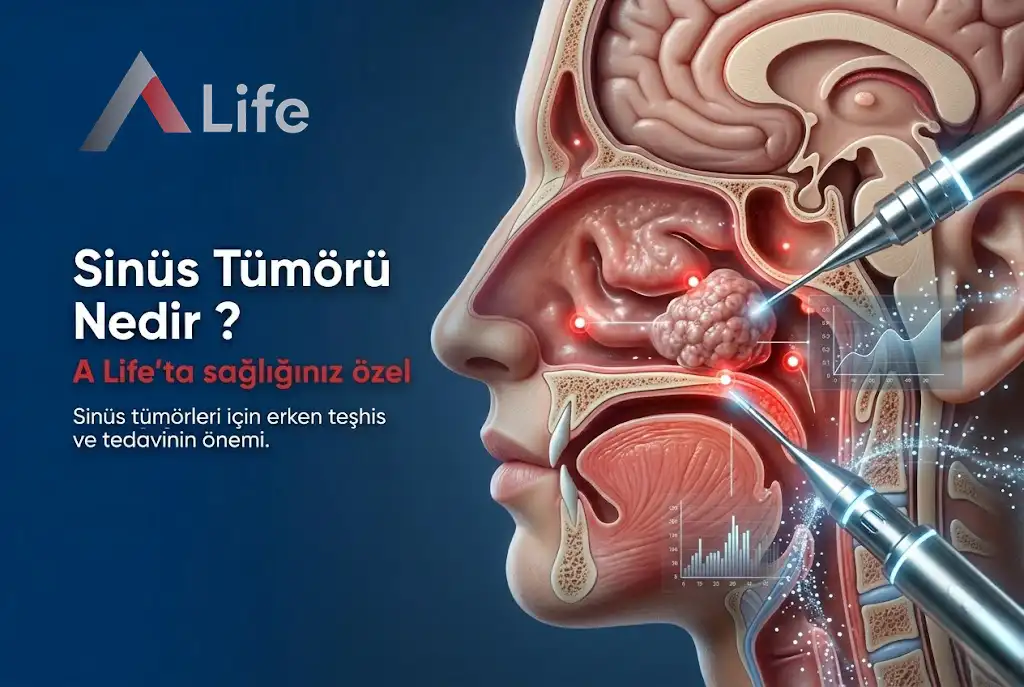 Sinüs Tümörü Nedir ?