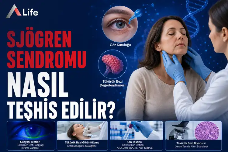 sj__gren-sendromu-nasil-teshis-edilir_271aa16d.webp