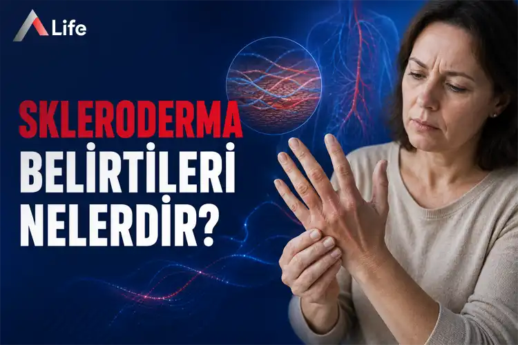 skleroderma-belirtileri-nelerdir_9ee012c2.webp