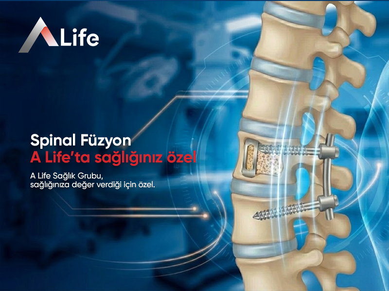Spinal Füzyon Nedir?