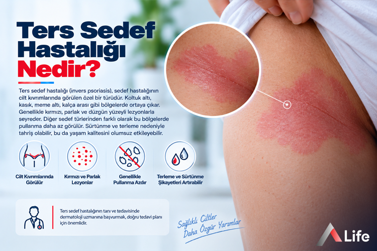 ters-sedef-hastaligi-nedir_bf213a52.webp