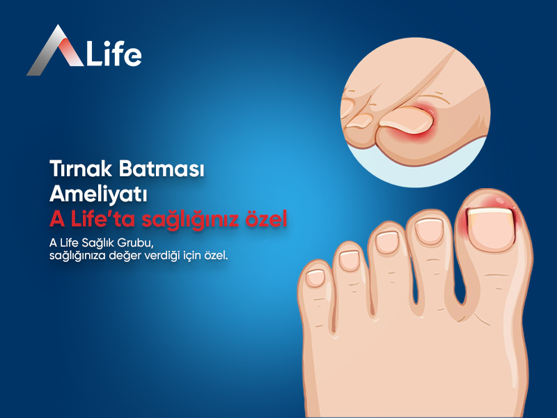 Tırnak Batması Ameliyatı