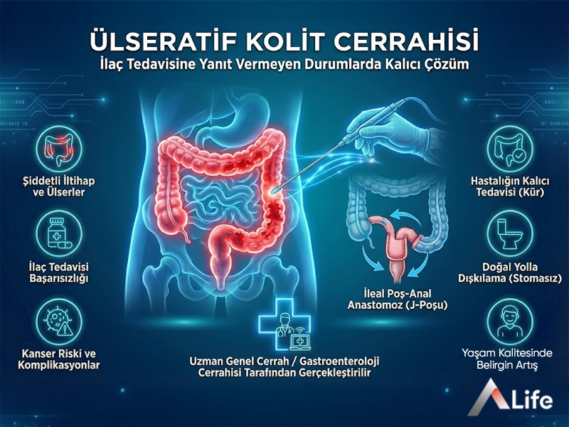 Ülseratif Kolit Cerrahisi