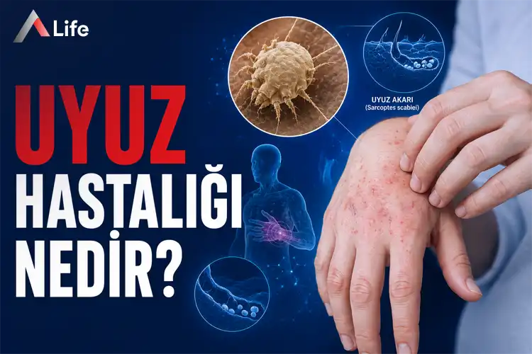 uyuz-hastaligi-nedir_0d4b42b8.webp