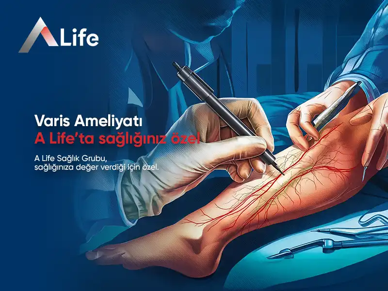 Varis Ameliyatı Nedir? | Varis Ameliyatı Nasıl Yapılır?