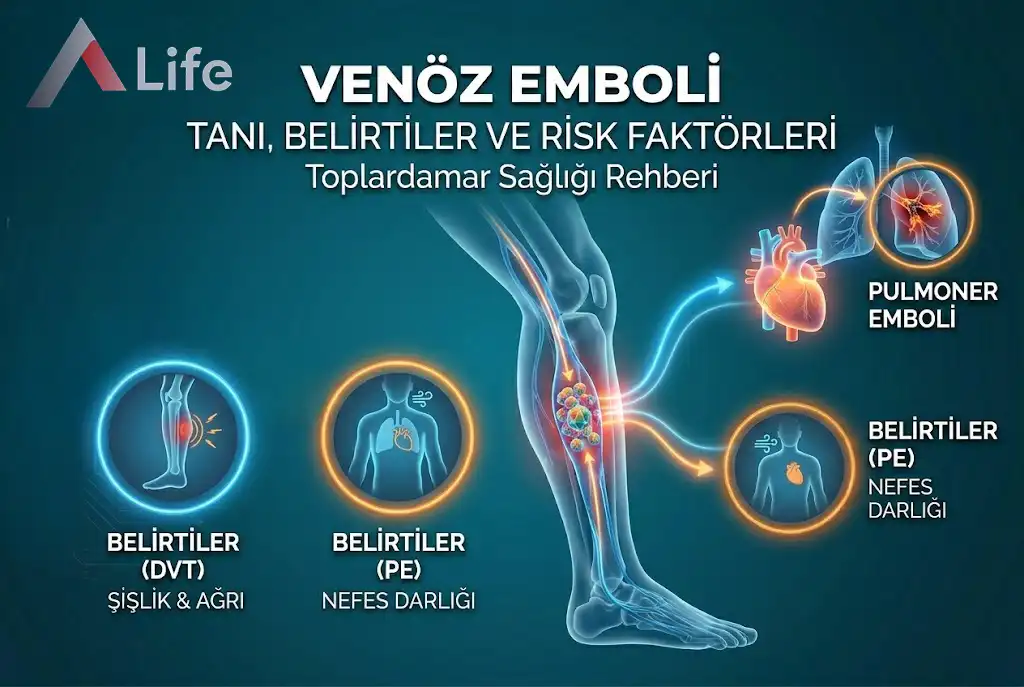 Venöz Emboli