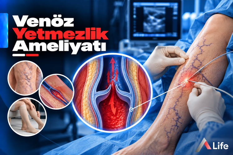venoz-yetmezlik-ameliyati_3b0c356f.webp