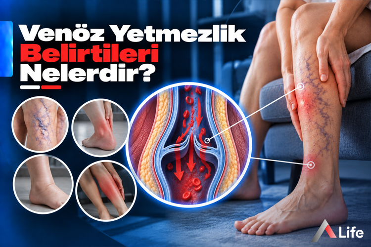 venoz-yetmezlik-belirtileri-nelerdir_8b327499.webp