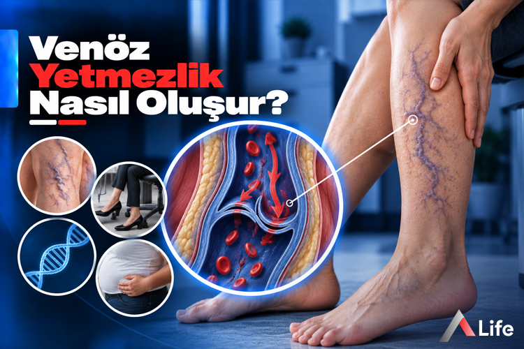 venoz-yetmezlik-nasil-olusur_233b2ea9.webp