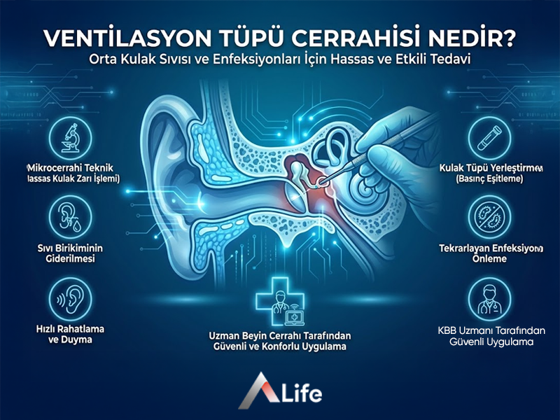 Ventilasyon Tüpü Cerrahisi Nedir?