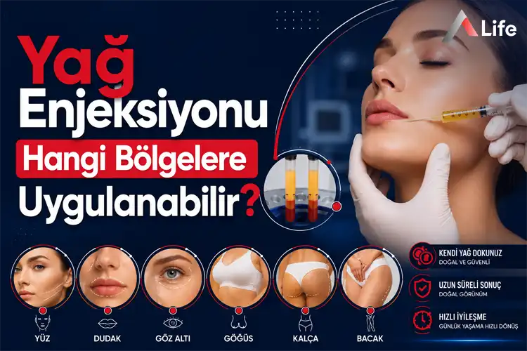 yag-enjeksiyonu-hangi-bolgelere-uygulanabilir_49e025fd.webp