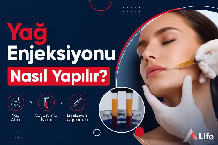 yag-enjeksiyonu-nasil-yapilir_1fd837c9.webp