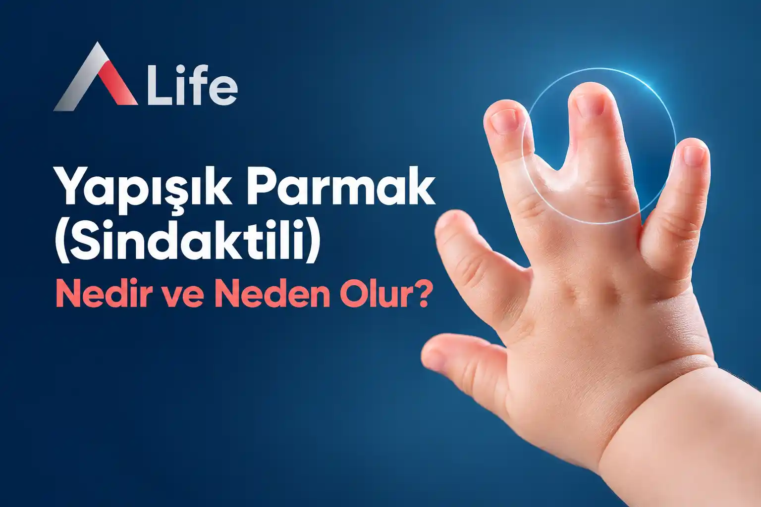 yapisik-parmak-sindaktili-nedir-a-life-saglik-grubu-ankara_359739bc.webp