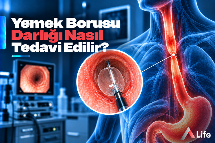 yemek-borusu-darligi-nasil-tedavi-edilir_0a908ac3.webp