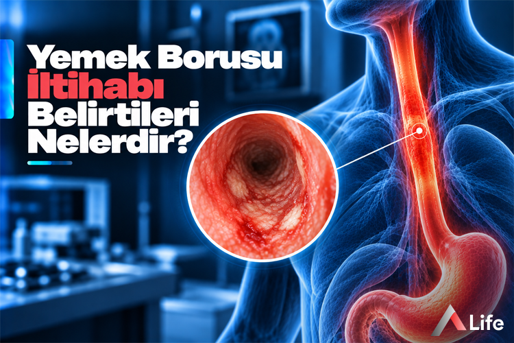 yemek-borusu-iltihabi-belirtileri-nelerdir_97680702.webp