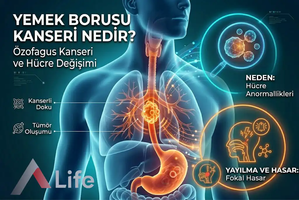 Yemek Borusu Kanseri Nedir ?