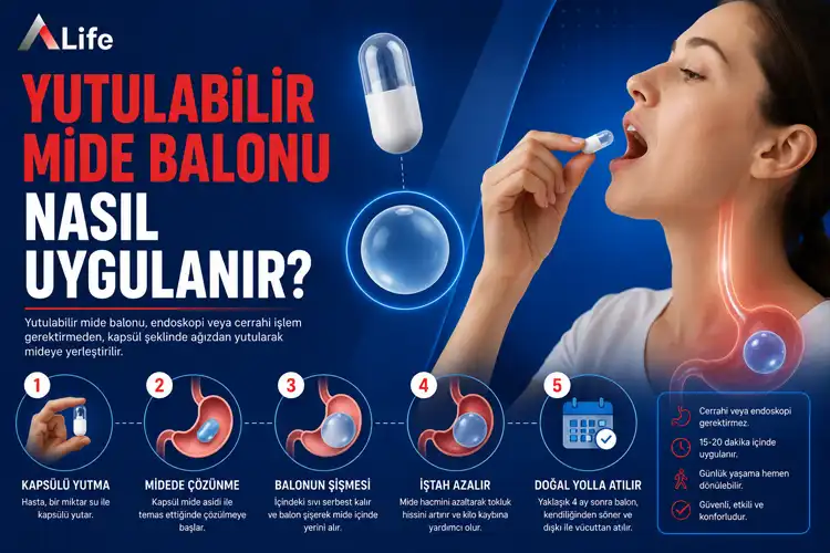 yutulabilir-mide-balonu-nasil-uygulanir_e5db4992.webp
