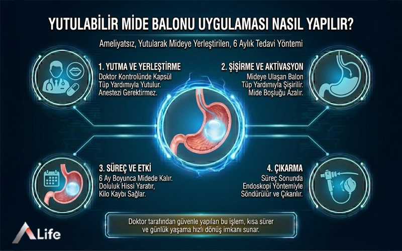 yutulabilir-mide-balonu-uygulamasi-nasil-yapilir-adim-adim-surec-yutma-sisirme-ve-endoskopik-cikarma_a0b99f3c.webp