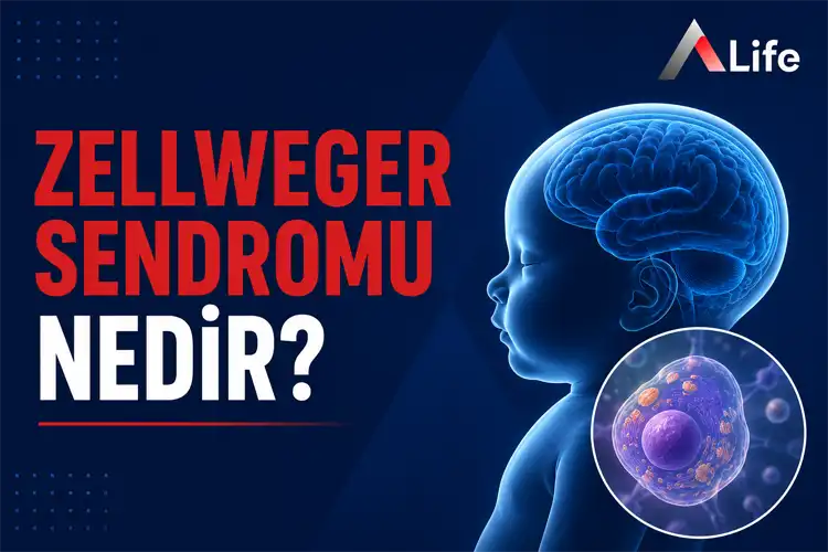zellweger-sendromu-nedir_4735c7fb.webp
